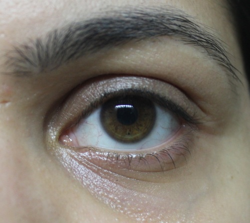 Bare Eye! darkest pigmentation is in the inner corners.